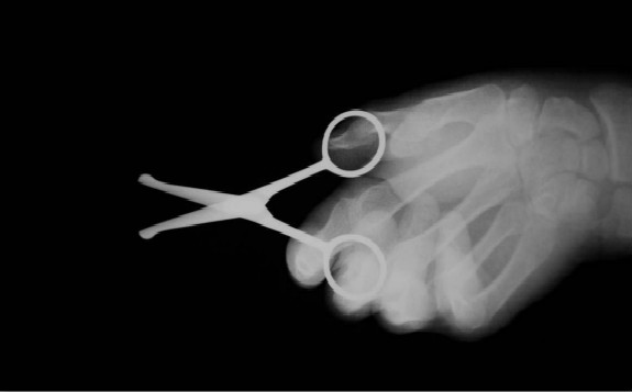 美国使用相控阵超声波检测技术替换X射线照相检验