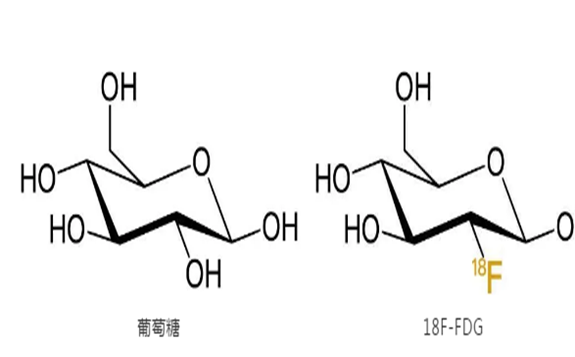发现肿瘤的核医学“葡萄糖”