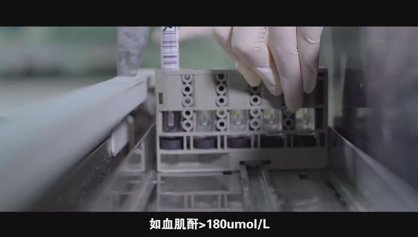 肿瘤放射治疗流程