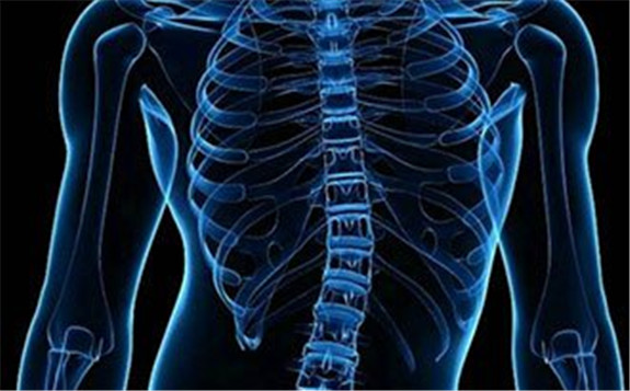 理大便携式无辐射超声波成像系统 有助大规模筛查脊柱侧弯