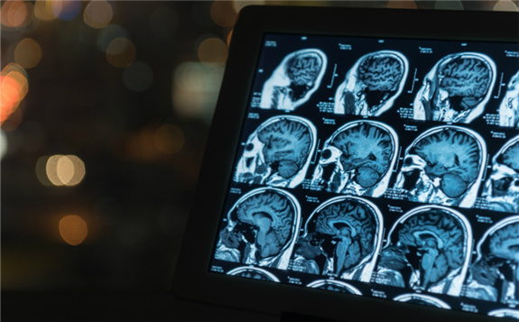 Covid-19爆发期间预计诊断成像设备的市场价值将强劲增长