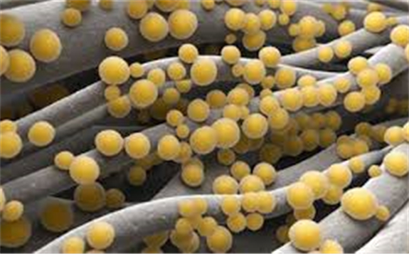 激光照射的新型铜源复合纳米银眼用凝胶，可成功治愈耐药金黄色葡萄球菌感染性角膜炎