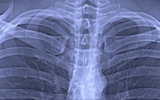 慕尼黑工业大学研究人员开发了用于肺部诊断的创新X射线方法
