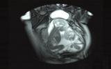 医疗科普：胎儿磁共振成像能做什么? 安全吗?