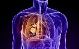 将基因组学与数学相结合 有助于个性化肺癌的放射治疗
