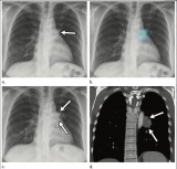 2020年5大X射线新闻