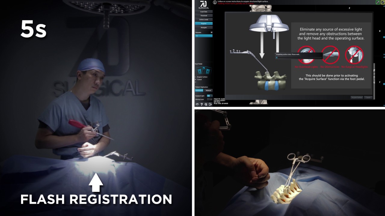 7D Surgical在欧洲扩展了无辐射脊柱外科手术工具