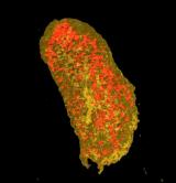 利用同步加速器产生的纳米级X射线束窥视细菌