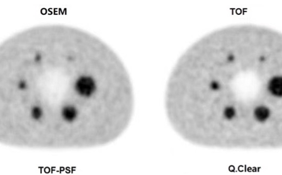 <p>山西医科大学第一医院PET/CT科研成果发表于Scientific Reports杂志</p>

