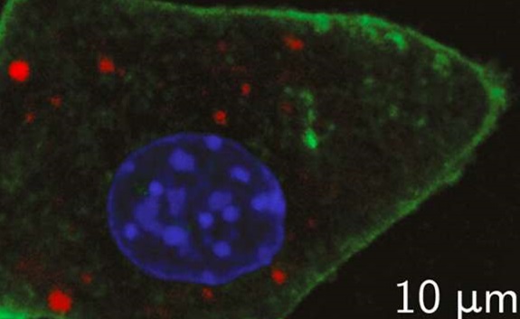 <p>新的纳米颗粒设计为改进肿瘤检测铺平了道路</p>
