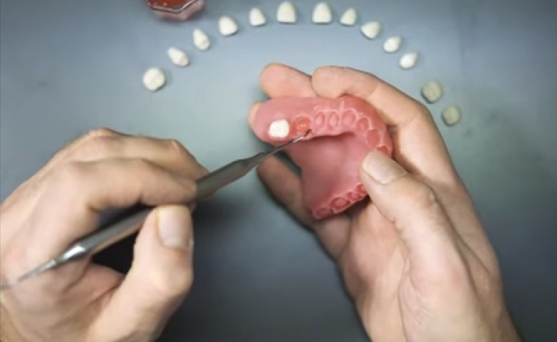 Dentafab的Powerresins获准在欧洲用于3D打印牙冠和假牙