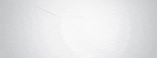 定制足托，3D数字化技术帮助烧伤患者正常行走