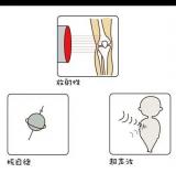 辐射成像科普：CT与MRI、超声检查有何区别?