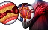 AI 在 3 秒内通过 MRI 扫描计算心脏周围的脂肪堆积