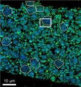 X 射线实验揭示了保护电池性能的新线索
