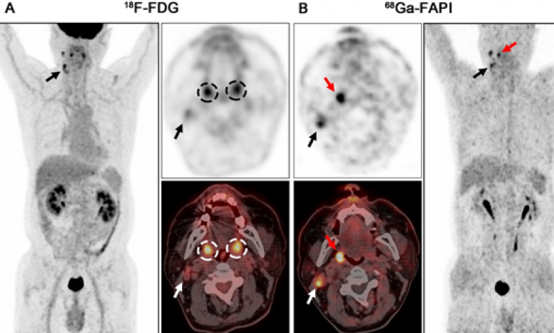 复旦大学附属肿瘤医院核医学科研究成果在国际权威期刊JNM上发表