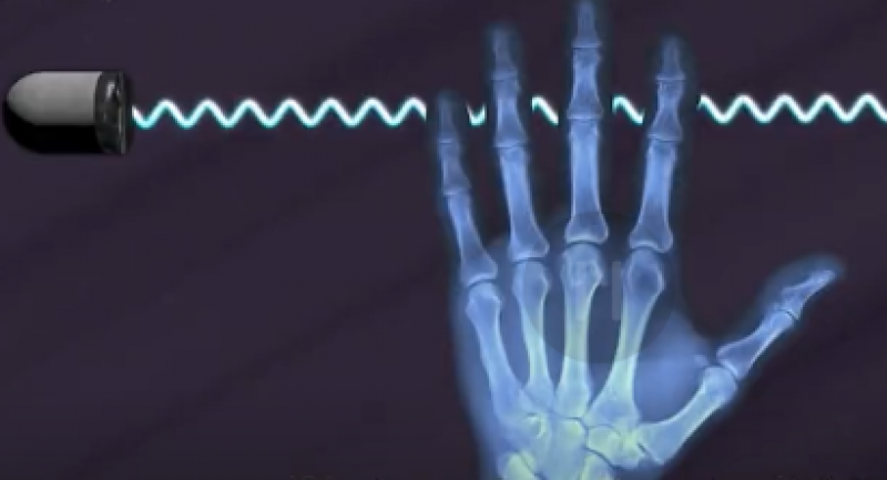 CT扫描仪是如何给你做身体检查的