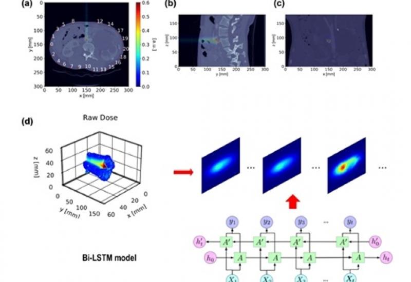 武汉大学、中国科大利用声波信号在线监测质子治疗剂量