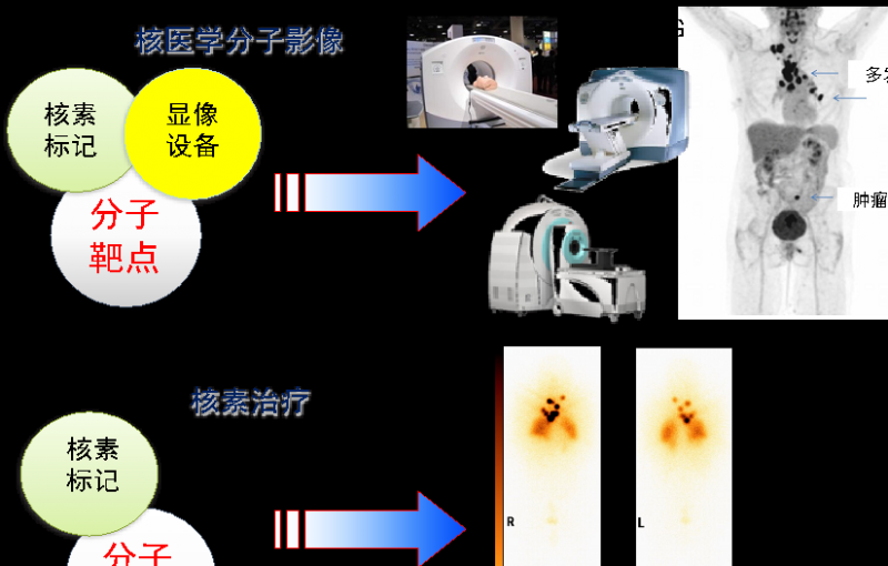 抗击肿瘤的“核”武器