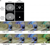 等效水直径和体型特异性辐射剂量对CT管电压的依赖性