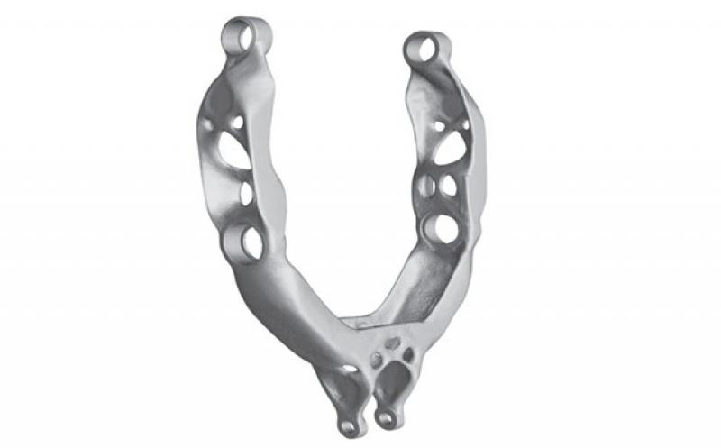 从设计到生产，CT检测在增材制造工艺链中发挥什么作用？