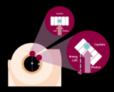 点扩散函数如何提升PET性能