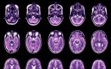 科学家们绘制出了人类生命周期中的大脑图表