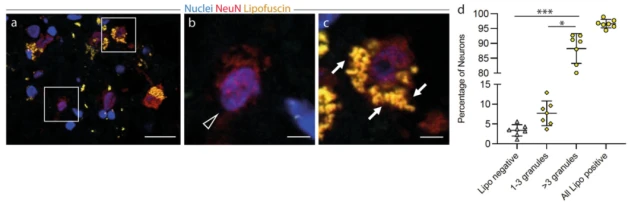 干细胞再现新争议?同位素标记发现杏仁核以最低2.7%速率更新神经元