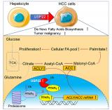 揭示肝癌脂代谢异常的关键分子机制，为靶向治疗提供新的科学依据