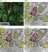 科学家利用同步辐射X射线断层扫描开发出一种能生成整个大脑网络的亚细胞图的新成像技术