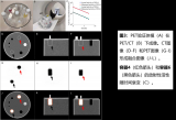 质子治疗的PET/CT验证显像 