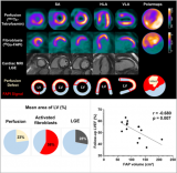 SNMMI年度图像：新的生物标记预测心脏病发作后心脏重塑的严重程度 