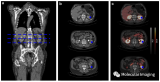PET/CT核医学分子影像，EJNMMI|[68Ga]Ga-FAPI 摄取与慢性肾病的进展相关