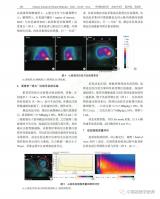D-SPECT 心肌血流定量操作规范专家共识