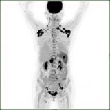 冀之光·2022 河北核医学线上病例讨论会(第五期)