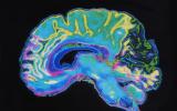 新核磁共振技术缩小了追踪大脑活动的时间尺度