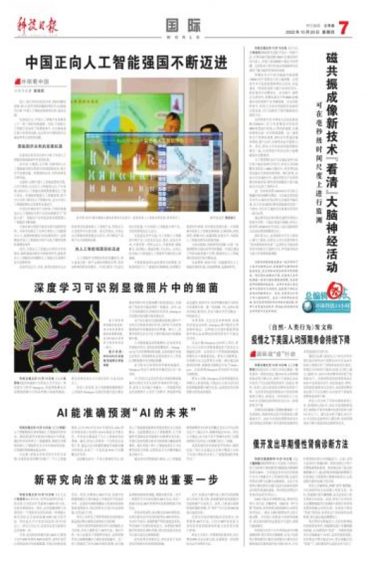 磁共振成像新技术“看清”大脑神经活动，可在毫秒级时间尺度上进行监测