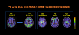 东诚药业全资子公司引进Tau蛋白正电子摄影示踪剂产品