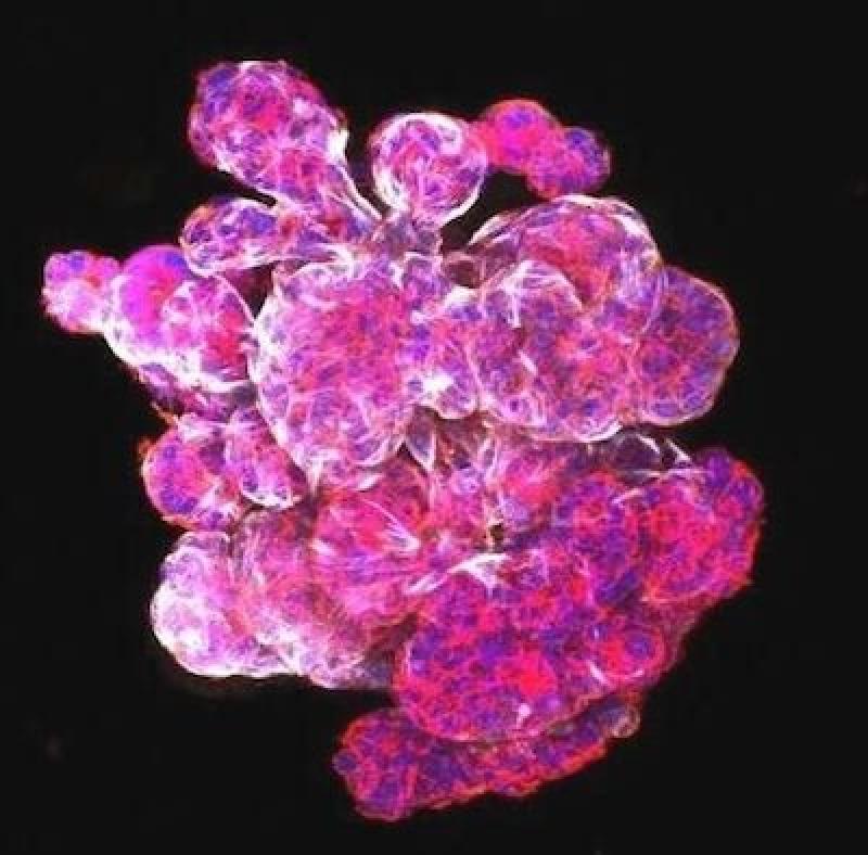 靶向放射治疗，Nature Cancer发现免疫疗法对最难治疗的乳腺癌无效的原因