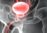 PSMA-PET成像剂64Cu-SAR bisPSMA的试验符合主要终点