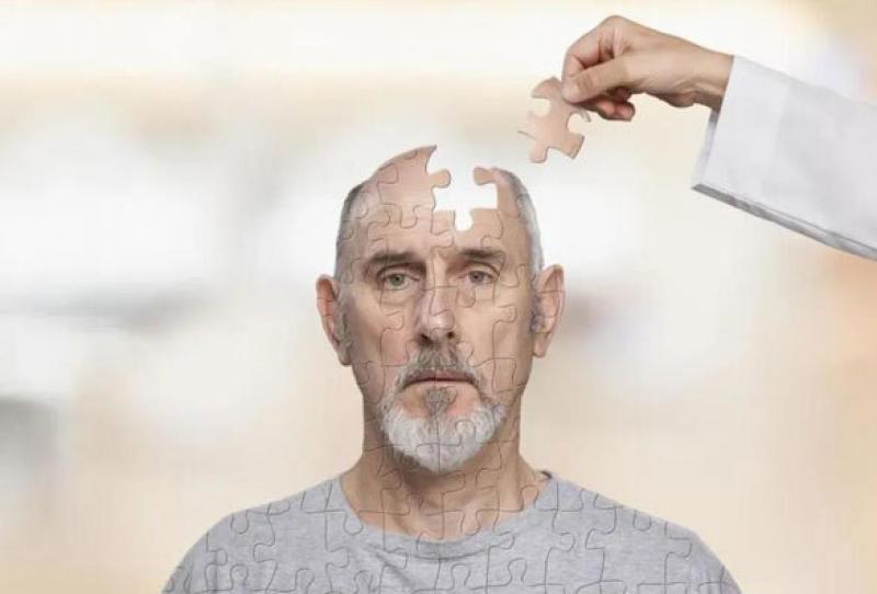 Tau PET最适合预测阿尔莫茨海默症患者的认知能力下降