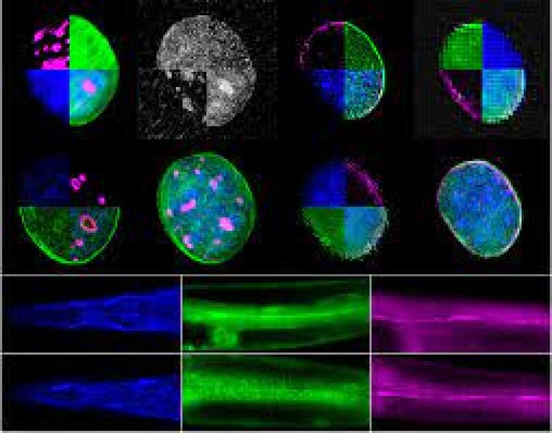“湖北造”新一代高端磁共振装备 获批医疗器械注册