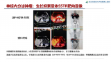 ​哈医大肿瘤医院成功开展生长抑素受体+糖代谢双示踪剂精准显像让神经内分泌肿瘤无处遁形