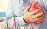 核医学|新冠感染后心慌、胸痛查因的利器 ——心肌血流灌注显像
