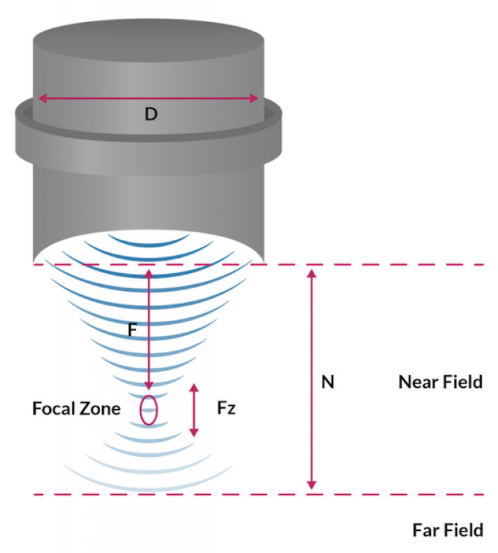 英国聚焦超声基金会宣布启动