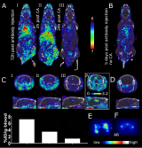 放射性标记抗体的功能化以增强高对比度脑成像的外周清除率