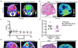 结核性脑膜炎动物模型和人类研究中的18F-pretomanid PET/CT动态扫描成像
