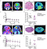结核性脑膜炎动物模型和人类研究中的18F-pretomanid PET/CT动态扫描成像