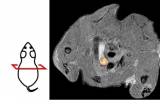 研究:PET/MRI模型可能有助于追踪动脉粥样硬化的发展