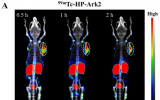 试点研究：基于新型肽类示踪剂99mTc-HP-Ark2对乳腺癌患者HER2的分子成像